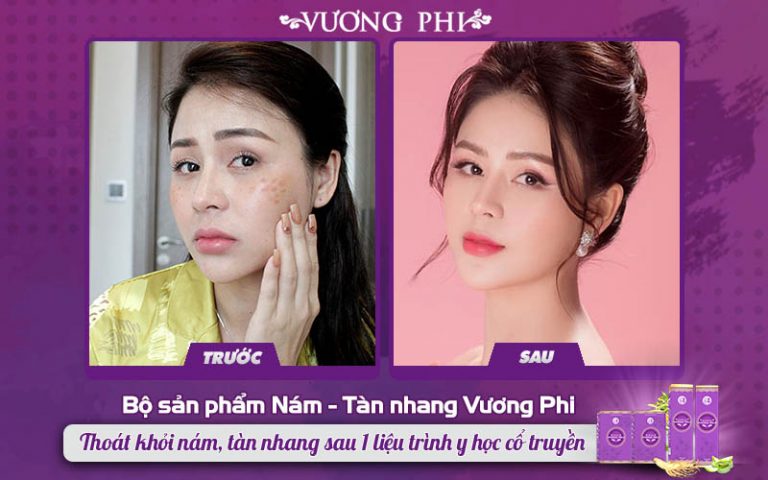 Hình ảnh diễn viên Lương Thu Trang TRƯỚC và SAU sử dụng bộ sản phẩm Vương Phi